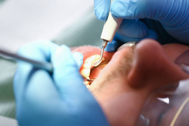 Best Urgent Tooth Repair  in Buffalo, SC